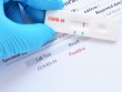 Futbolçular hər oyundan əvvəl koronavirus testindən keçəcək