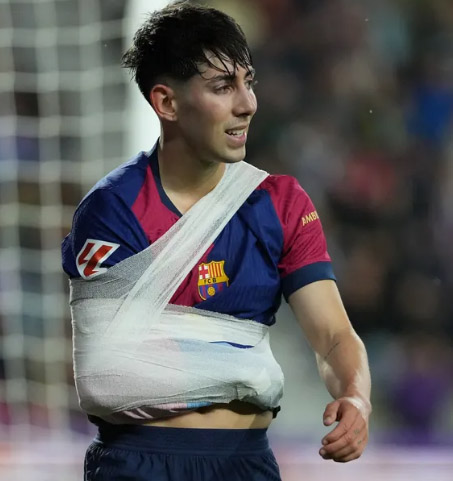&quot;Barselona&quot;nın daha bir futbolçusu zədə səbəbindən mövsümü başa vurdu